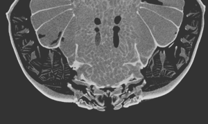 アカテガニを横に切った断面CT画像